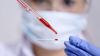 Bei einer Blutuntersuchung werden die Inhaltsstoffe deines Blutes genau analysiert.