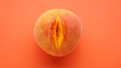 Die Ursache für eine geschwollenen Vagina kann eine Bartholiniti-Zyste sein.