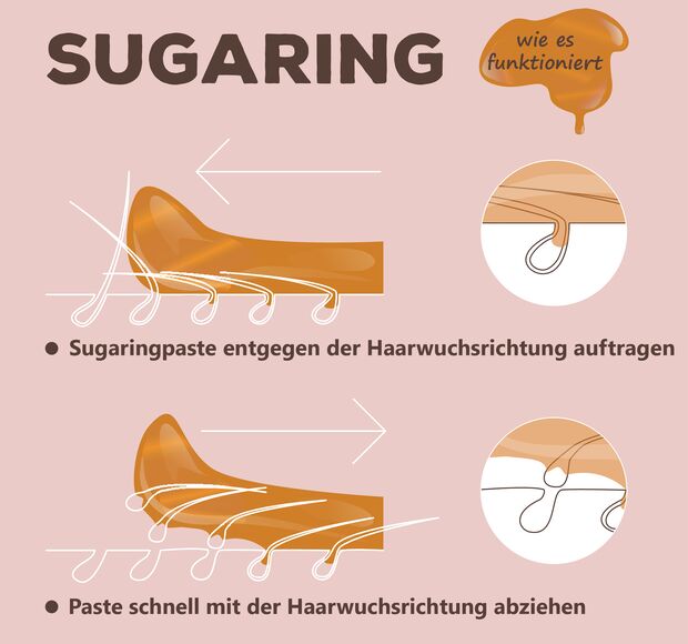 So funktioniert Sugaring