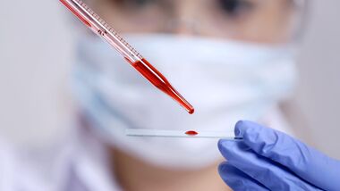 Was ein Bluttest über die Gesundheit verrät