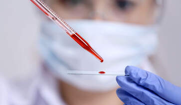 welche eisenwwerte im blut abnehmen lassen